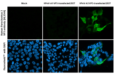 Anti-Human Parechovirus 3 VP3 antibody [HL2544] used in Immunocytochemistry/ Immunofluorescence (ICC/IF). GTX638913